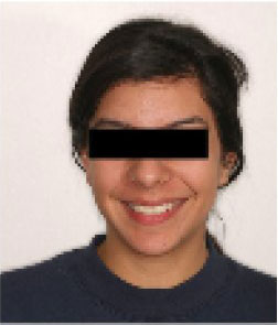 after getting orthodontic treatment