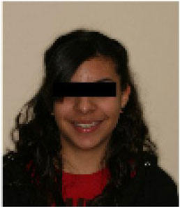 before getting orthodontic treatment